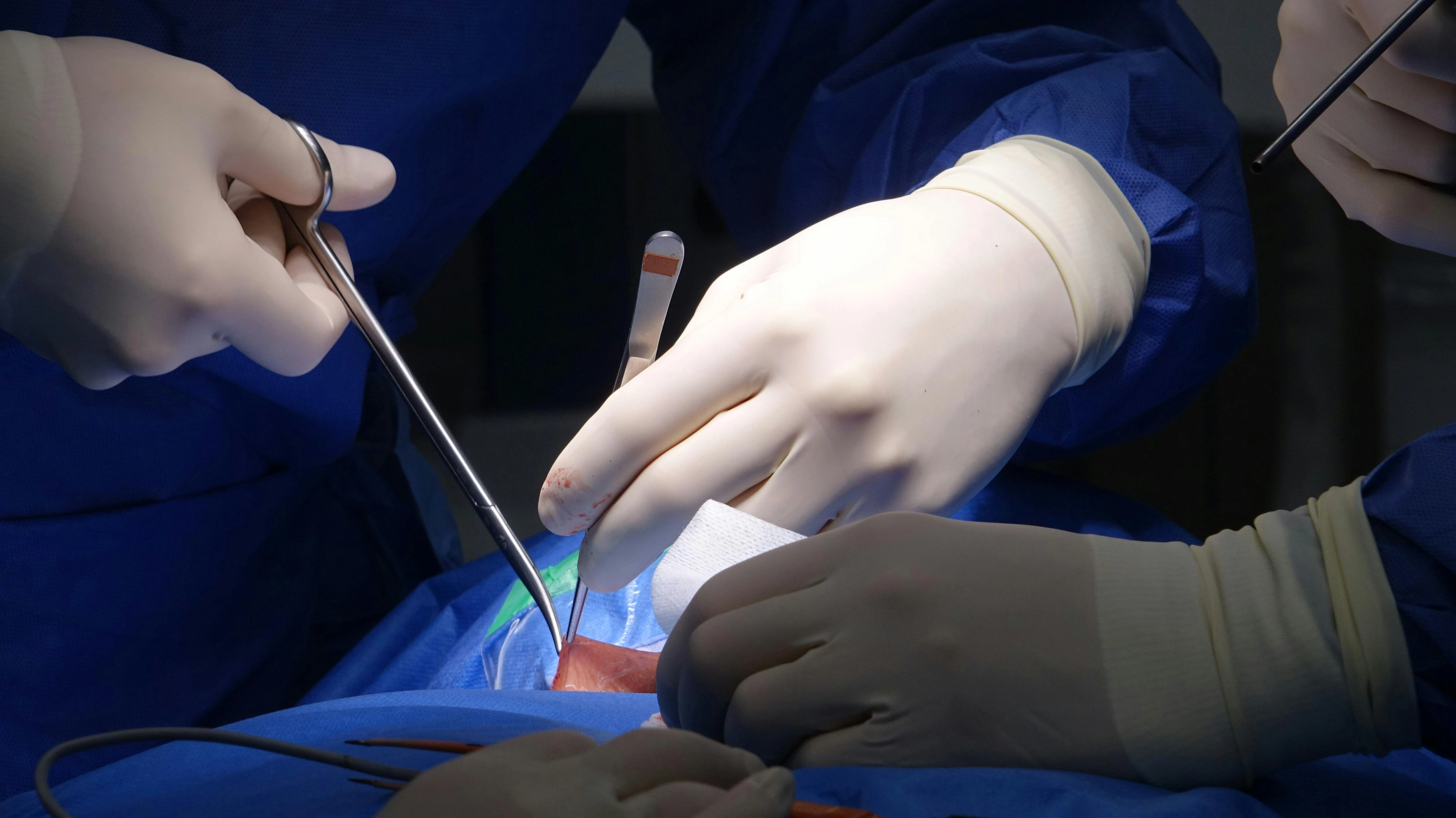 Post Surgery Depression: How Long Does It Really Last?